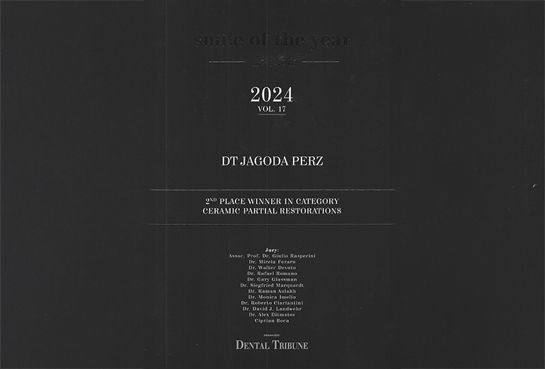 Międzynarodowy Konkurs Smile of The Year 2024 by Dental Tribune II miejsce